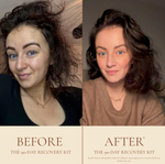 The Serenoa Serum